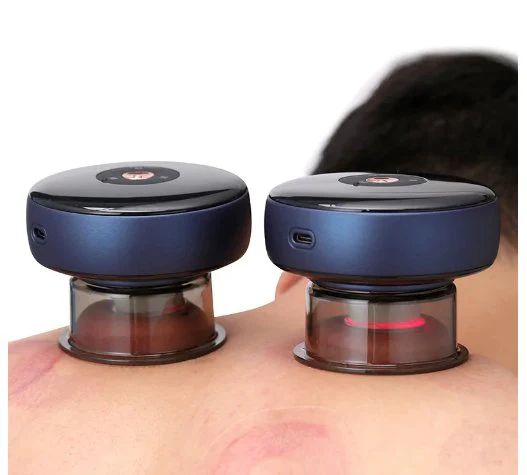 Electric Vacuum Cupping Massager – Pain Relief & Muscle Relaxation